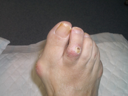 Imatge real pre operat�ria